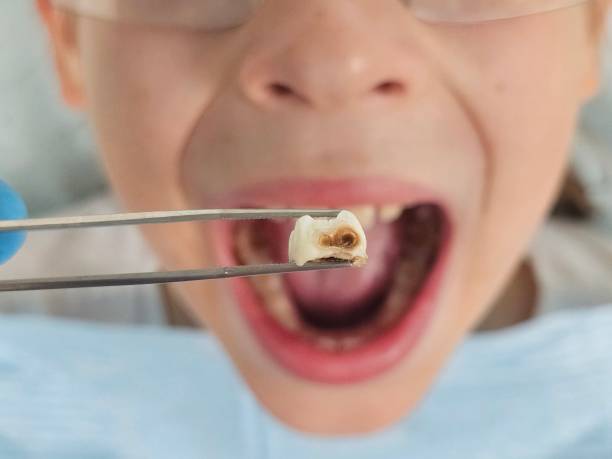 Best Knocked-Out Tooth Emergency  in Lmer Heights, PA